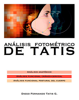Análisis Fotométrico de Tatis