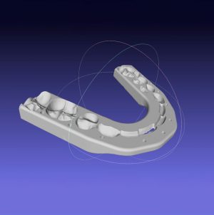 S.T.L. de Ferula Quirúrgica